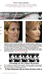 Mobile Screenshot of nyccollagen.org